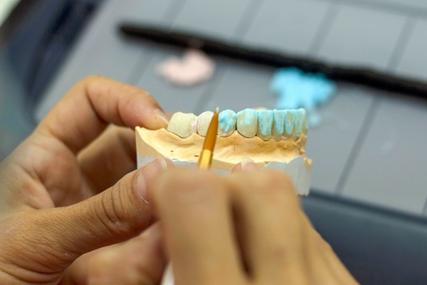 Full Mouth Reconstruction For Smile Esthetic, Health, And Function