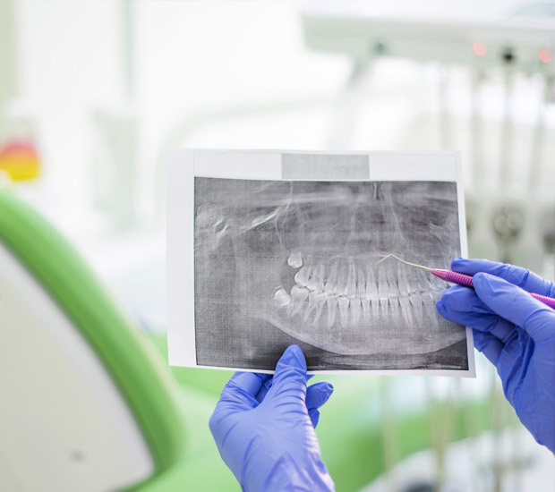 Atlanta Interactive Periodontal Probing